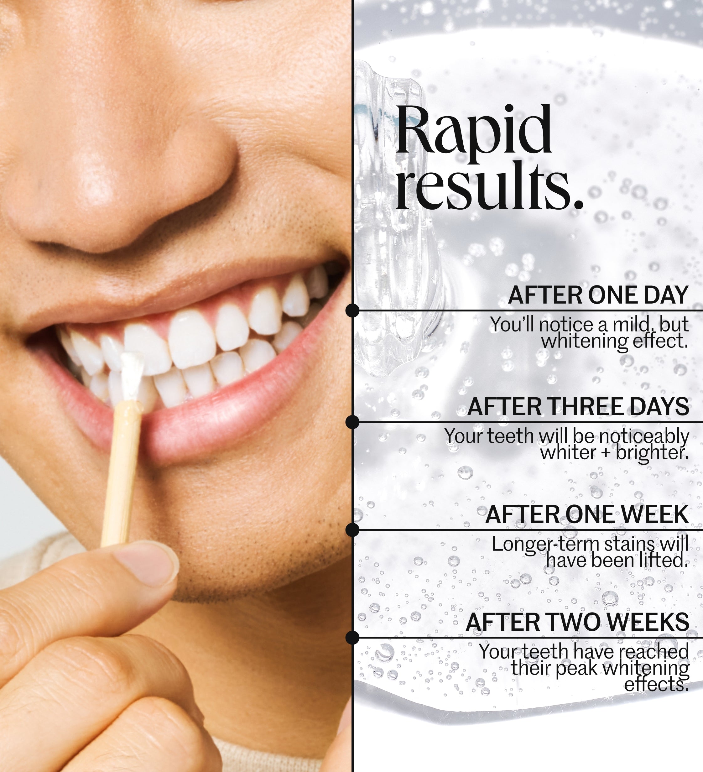 The Everyday Whitening System – Bite